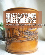 重庆治疗银屑病好的医院在哪【开云体育】(图1) 开云体育